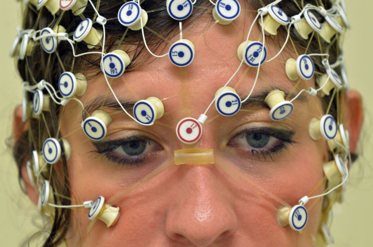 BRAIN RESEARCH